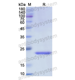 重組FDXR蛋白,Recombinant Human FDXR, N-His