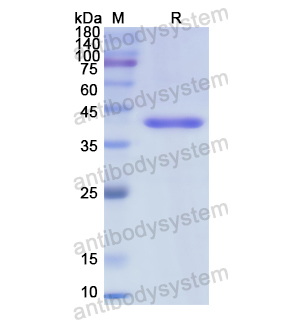 重组TGM1蛋白,Recombinant Human TGM1, N-His