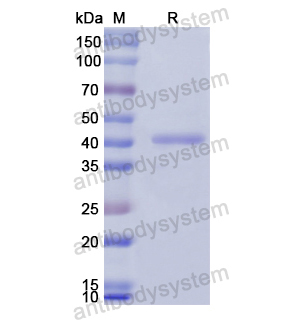 重組PROZ蛋白,Recombinant Human PROZ, N-GST