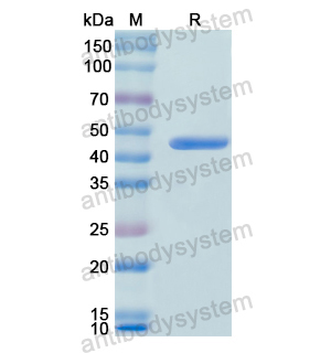 重组MMP8蛋白,Recombinant Human MMP8, N-His