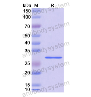 重組PTGS1蛋白,Recombinant Human PTGS1, N-His