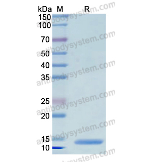 重組S100A1蛋白,Recombinant Human S100A1, N-His