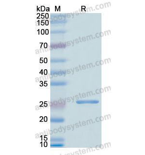 重组ME2蛋白,Recombinant Human ME2, N-His