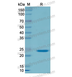 重組SP100蛋白,Recombinant Human SP100, N-His