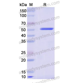 重組AHCY蛋白,Recombinant Human AHCY, N-His