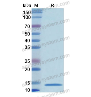 重组GATA2蛋白,Recombinant Human GATA2, N-His