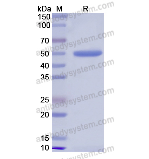 重组PRTN3蛋白,Recombinant Human PRTN3, N-GST
