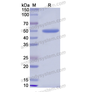 重組PRTN3蛋白,Recombinant Human PRTN3, N-GST