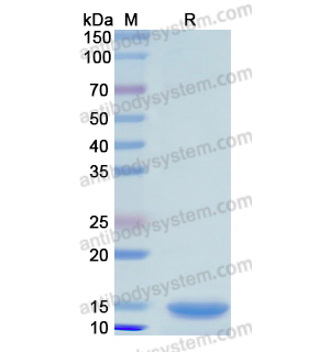 重组GPT蛋白,Recombinant Human GPT, N-His