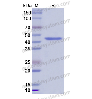 重組MMP11蛋白,Recombinant Human MMP11, N-His