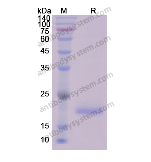 重組CCND1蛋白,Recombinant Human CCND1, N-His