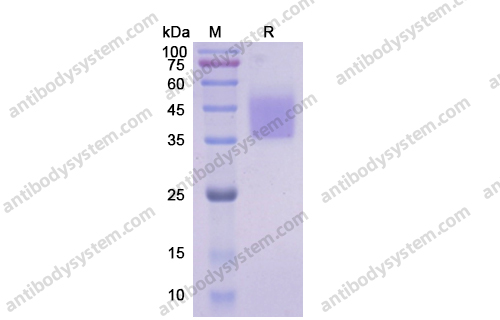 重組CD124/IL4R蛋白,Recombinant Human CD124/IL4R, C-His