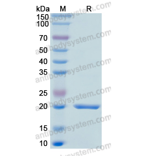 重组GADD45A蛋白,Recombinant Human GADD45A, N-His