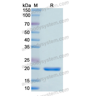 重組MYL9蛋白,Recombinant Human MYL9, N-His