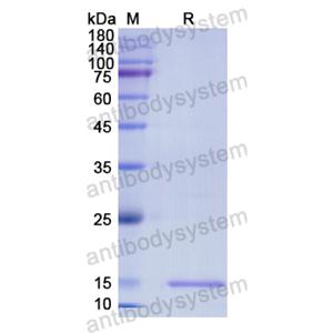 重組DRD5蛋白,Recombinant Human DRD5, N-His