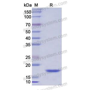 重组CD252/TNFSF4蛋白,Recombinant Human CD252/TNFSF4, N-His