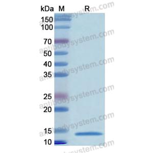 重组GATA2蛋白,Recombinant Human GATA2, N-His