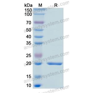 重组GADD45A蛋白,Recombinant Human GADD45A, N-His