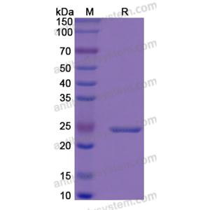 Recombinant Human IGFBP6, N-His