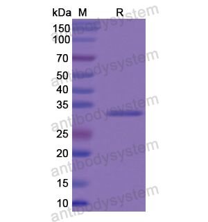 重組COL8A2蛋白,Recombinant Human COL8A2, N-His