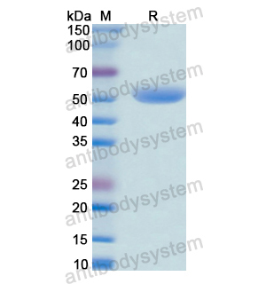 重组GRK2蛋白,Recombinant Human GRK2, N-GST