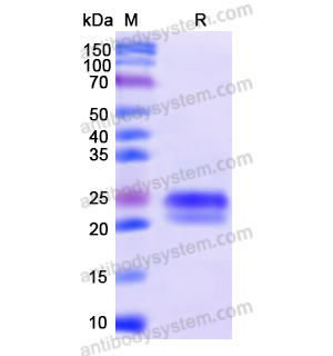 EDNRA,Recombinant Human EDNRA, N-His-SUMO