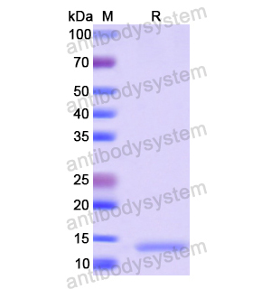 CXCR-7/ACKR3,Recombinant Human CXCR-7/ACKR3, N-His