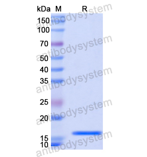 LAMA1,Recombinant Human LAMA1 Protein, N-His