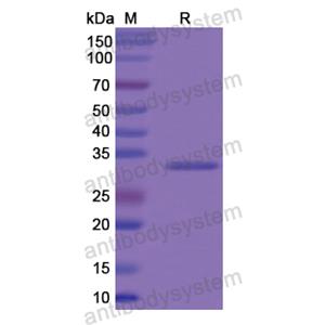 Recombinant Human COL8A2, N-His