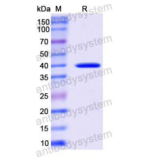 HSP40/DNAJB1,Recombinant Human HSP40/DNAJB1, N-His