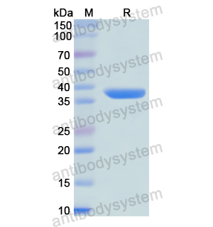 NPY1R,Recombinant Human NPY1R, N-GST