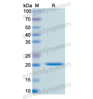 CD40/TNFRSF5,Recombinant Human CD40/TNFRSF5, N-His