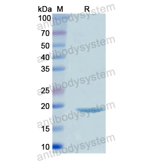 ITGB8,Recombinant Human ITGB8, N-His