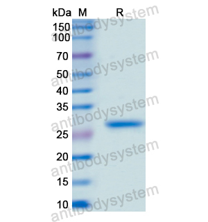 PAX6,Recombinant Human PAX6, N-His