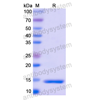 S100A4,Recombinant Human S100A4, N-His