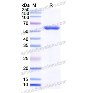 PTBP1,Recombinant Human PTBP1, N-His