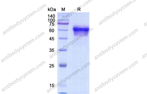 CD123,Recombinant Human CD123/IL3RA, C-His