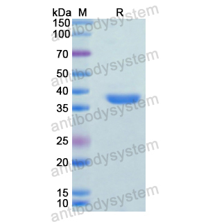 ANXA13,Recombinant Human ANXA13, N-His