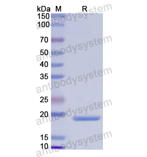 CALML3,Recombinant Human CALML3, N-His