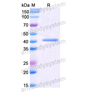 CD26,Recombinant Human CD26/DPP4, N-His