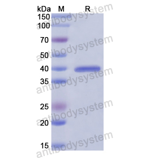 ARNT,Recombinant Human ARNT/HIF1-beta, N-His