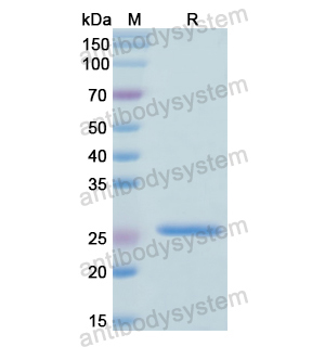 RPL10,Recombinant Human RPL10, N-His