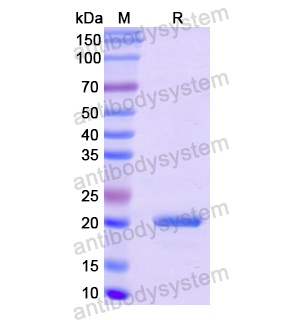 COL8A1,Recombinant Human COL8A1, N-His