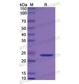 CALR,Recombinant Human Calreticulin/CALR, N-His