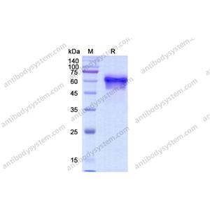 CD123,Recombinant Human CD123/IL3RA, C-His