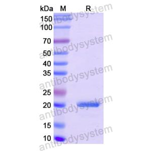 COL8A1,Recombinant Human COL8A1, N-His
