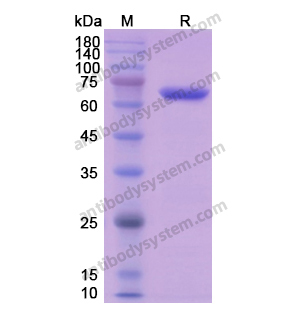 CANX,Recombinant Human CANX, N-His