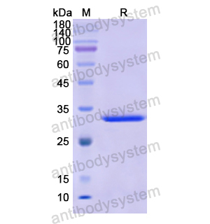 AOAH,Recombinant Human AOAH, N-His