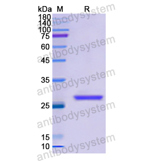 GSTM2,Recombinant Human GSTM2, N-His