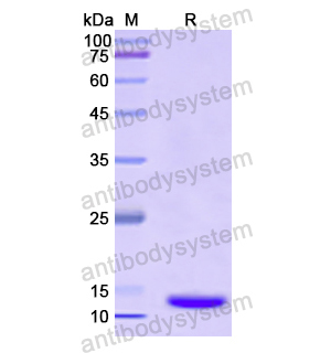 TMOD1,Recombinant Human TMOD1, N-His